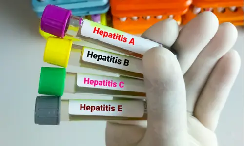 Health Insurance for Hepatitis A, B, & C