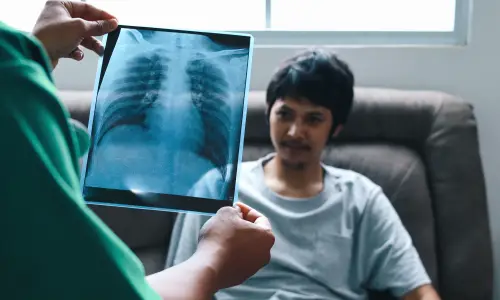 Health Insurance for Tuberculosis