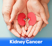 Kidney Cancer 